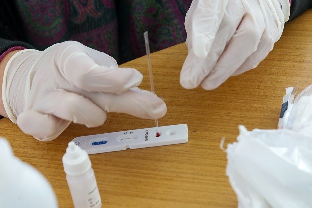 Municípios do Paraná recebem mais de 178 mil testes rápidos para detecção do Coranvírus
