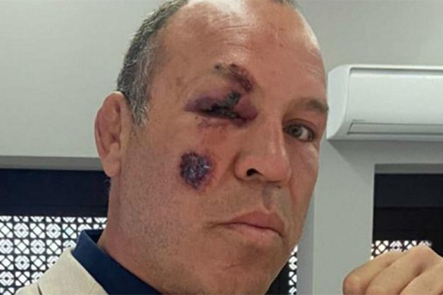 Wanderlei Silva, lutador de MMA é atropelado enquanto andava de bicicleta em Curitiba