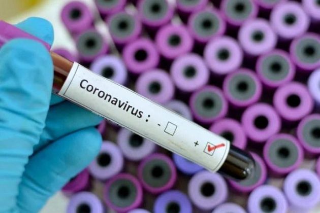 Professor de Universidade britânica acredita que coronavírus pode não ter surgido na China