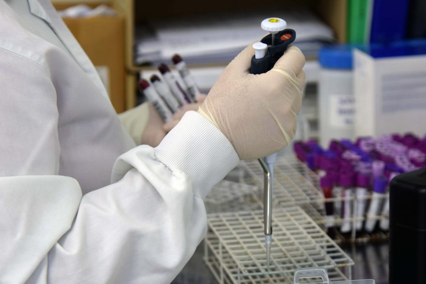 Paraná já realizou mais de 1 milhão de testes RT-PCR