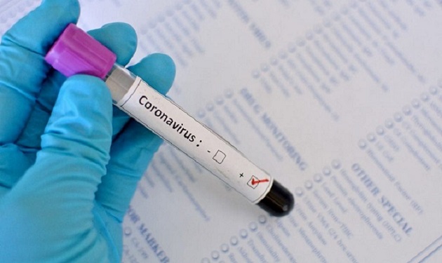 Boletim confirma mais 2.675 casos de Covid-19. Estado já imunizou 239.862 pessoas