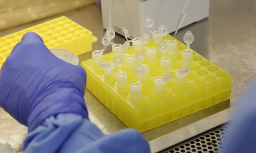 Boa notícia: Testes para vacina contra HIV têm resultados promissores