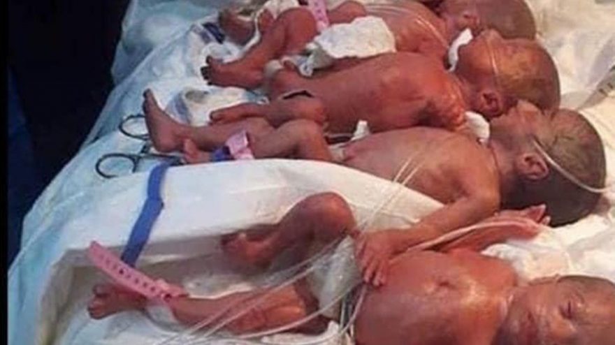 Em caso extremamente raro, mulher dá à luz a 9 gêmeos