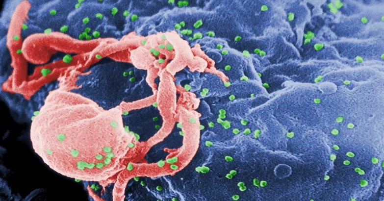 Engenharia genética busca maneiras de trancar o HIV dentro das células e eliminá-lo