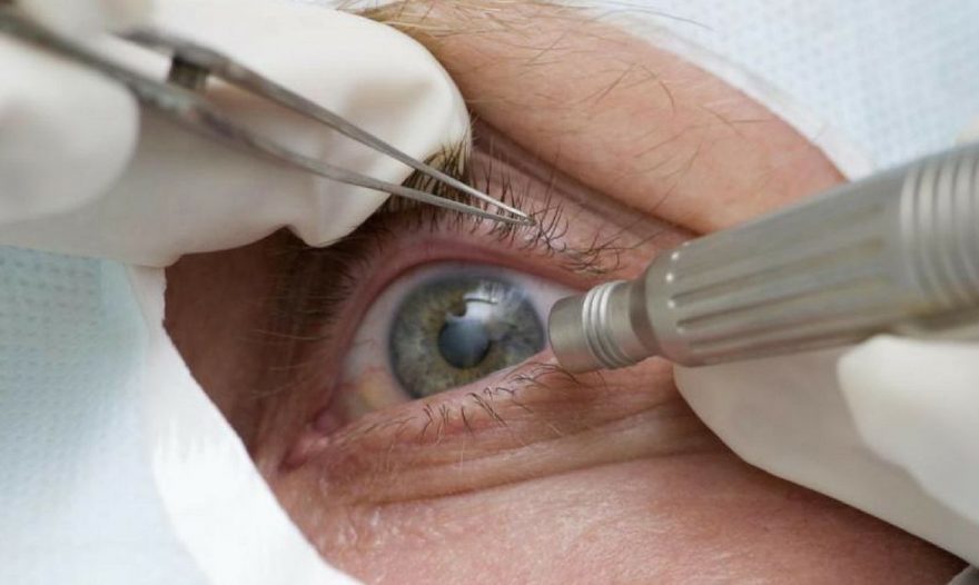 Abril Marrom alerta sobre doenças que podem levar à cegueira
