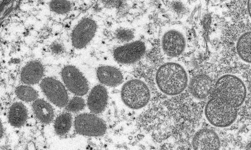 Brasil já tem cinco casos de varíola dos macacos